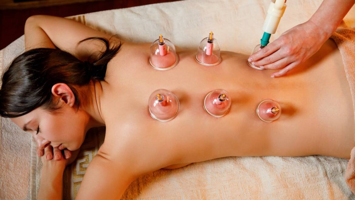 Cupping or Slide Cupping